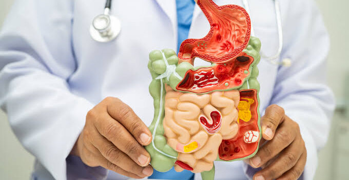 gut health and food culture
